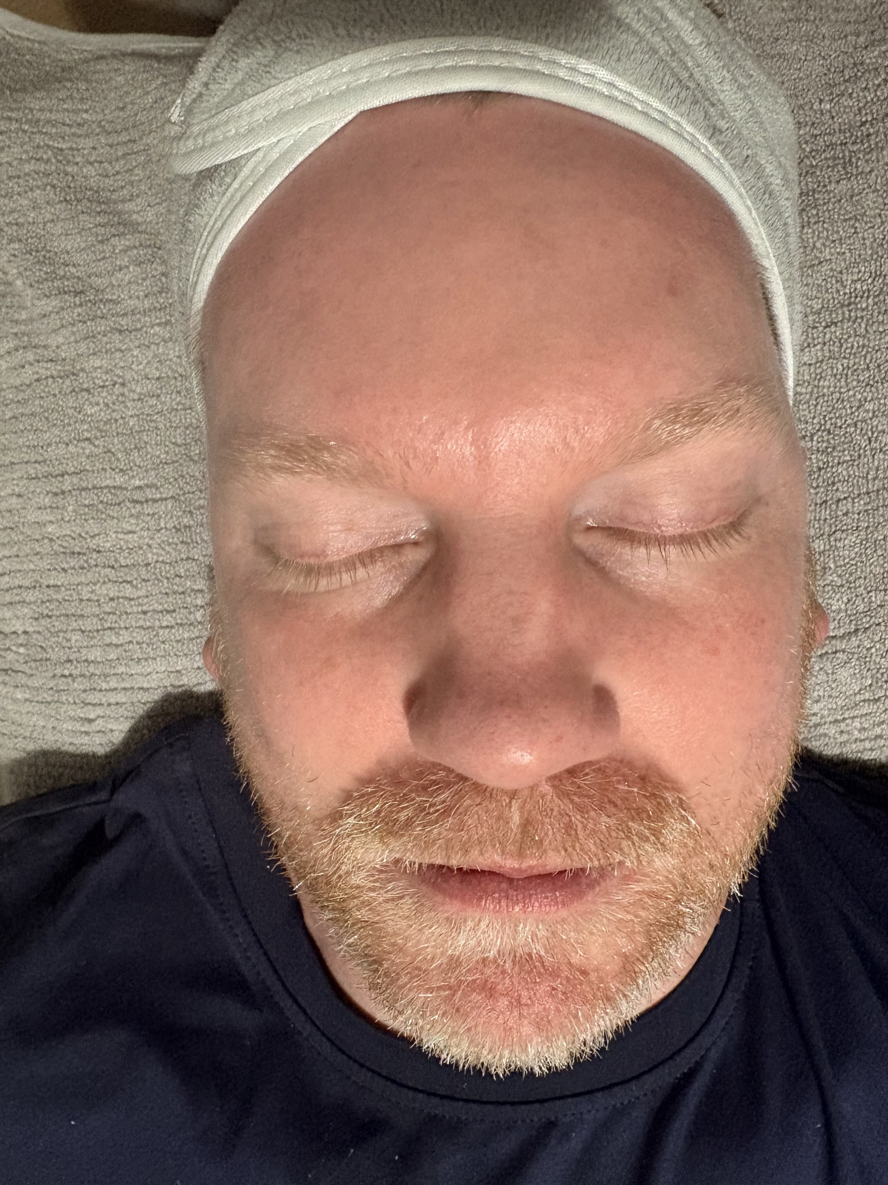 Before treatment